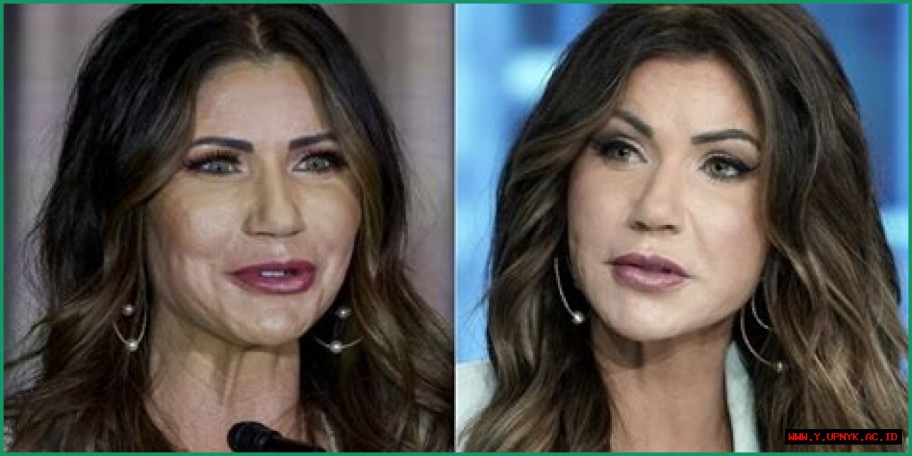 Discover The Transformation Kristi Noem Before Plastic Surgery Revealed!